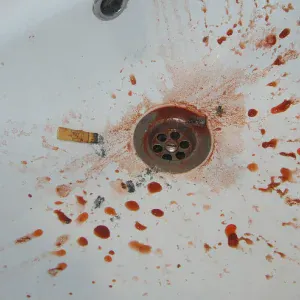 SPLASH OVERDOSE - НИКОГДА НЕ СПИ И НИЧЕГО НЕ ЕШЬ